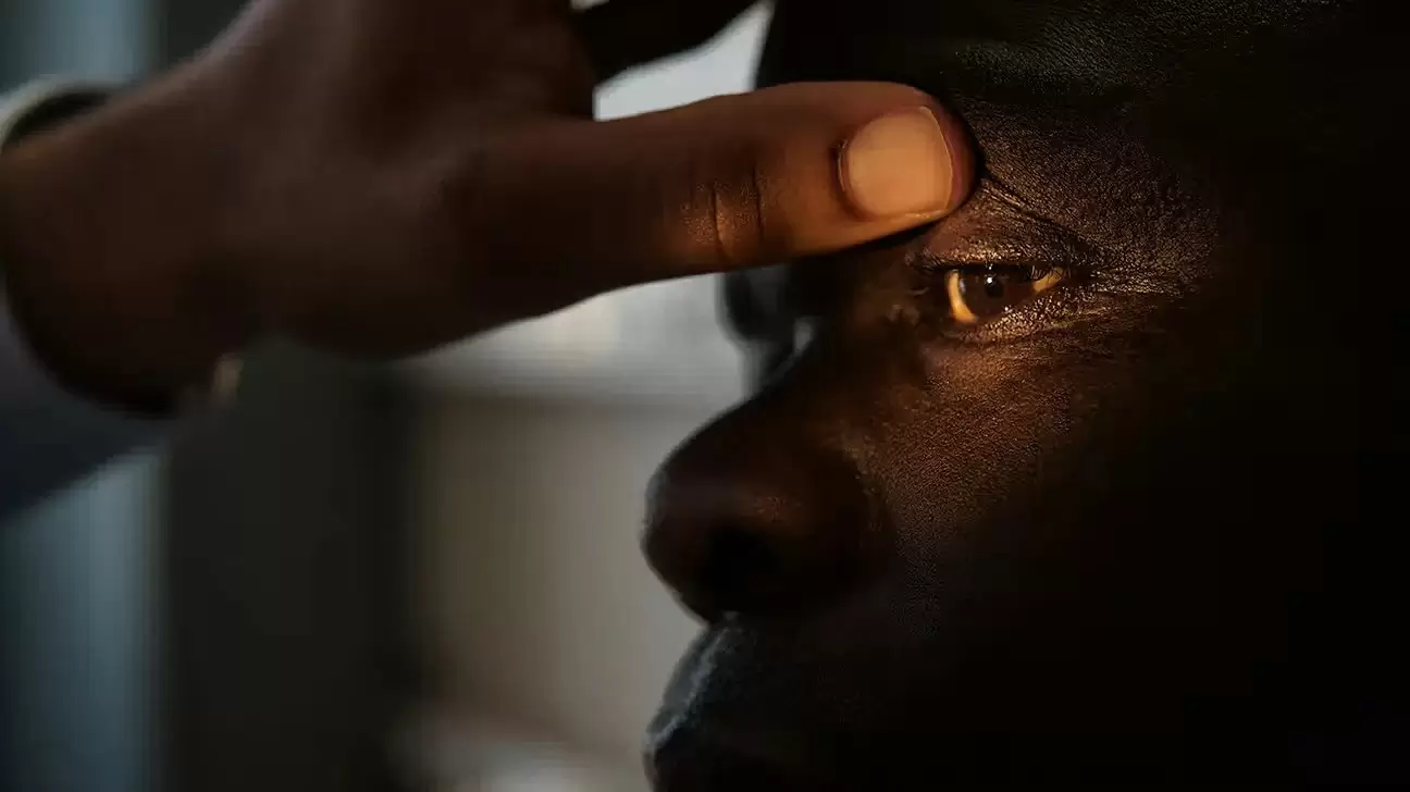 تشخیص ملانوم چشم